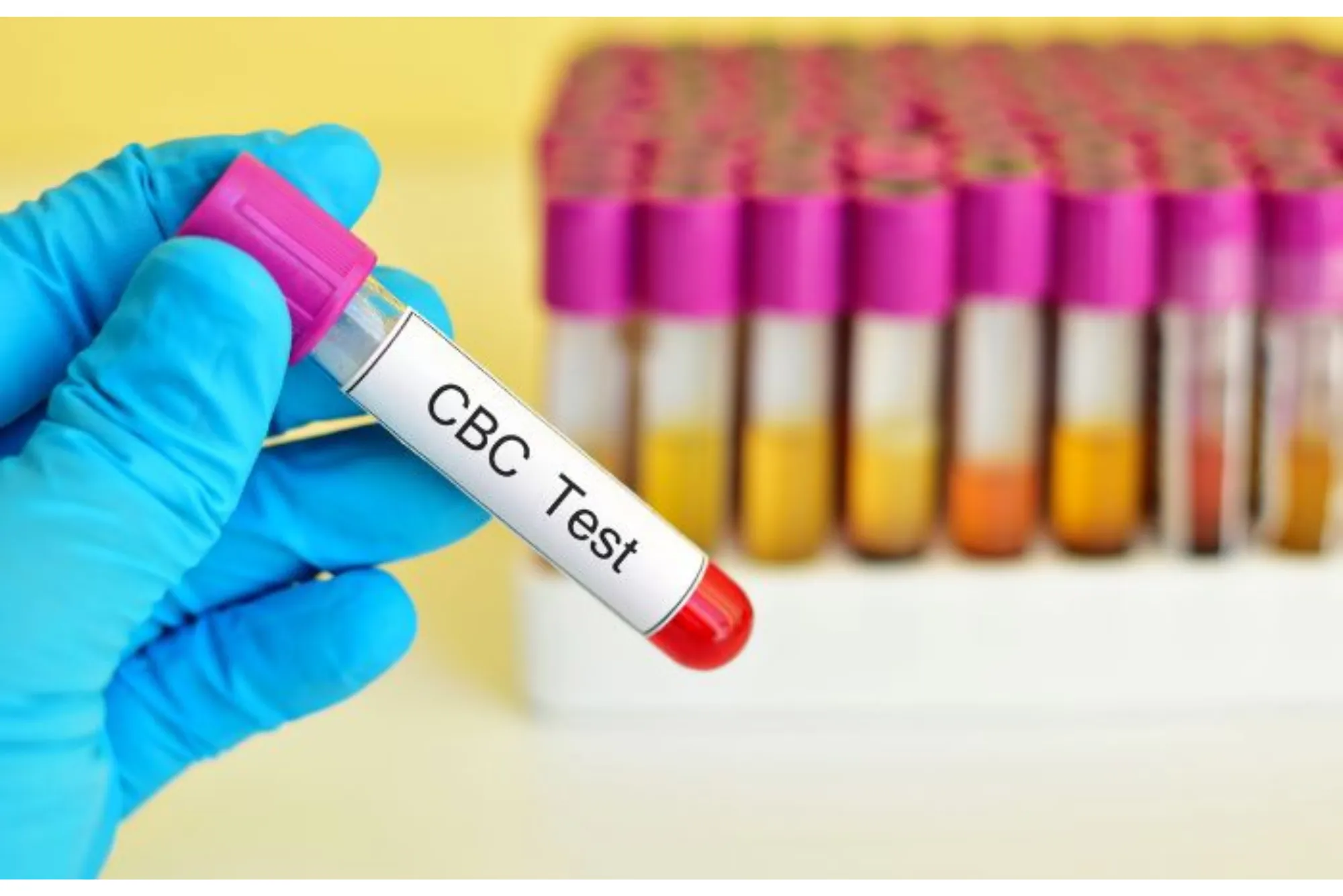 CBC Blood Test